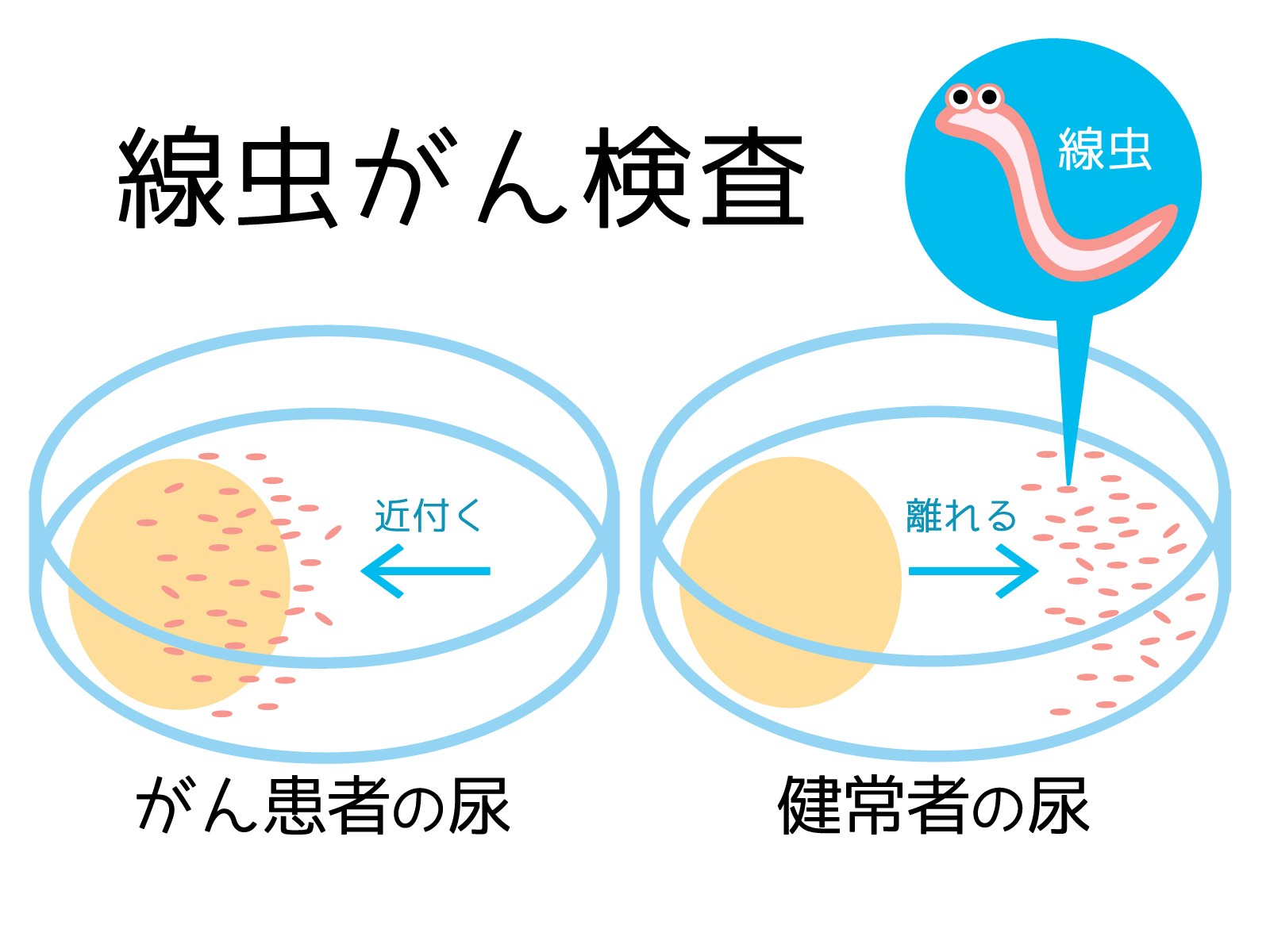尿1滴で線虫がん検査