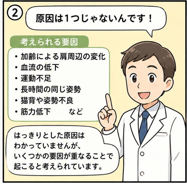 原因は1つじゃないんです!と話す白衣を着た医師と考えられる要因として「加齢による肩周辺の変化」「血流の低下」「運動不足」「長時間の同じ姿勢」などを解説するイラスト
