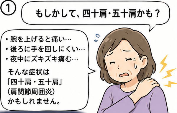腕を上げると痛い、後ろに手を回しにくい、夜中にズキズキ痛む、と肩を抑え痛そうにしている女性のイラスト