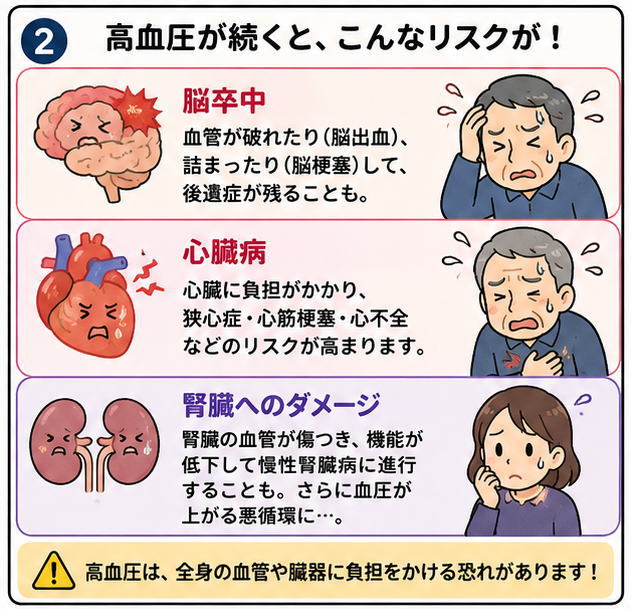 高血圧が続くと、こんなリスクが。という見出しと、脳卒中、心臓病、腎臓へのダメージについて説明しているイラスト。高血圧は、全身の血管や臓器に負担をかける恐れがあります、という文字。