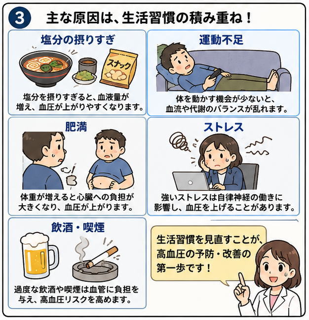 主な原因は、生活習慣の積み重ね!というタイトルと、「塩分の摂りすぎ」「運動不足」「肥満」「ストレス」「飲酒・喫煙」という高血圧の原因と、「生活習慣を見直すことが、高血圧の予防・改善の第一歩です」と話す白衣を着た女性のイラスト