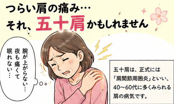 肩の痛み、五十肩かもしれません、と書いた文字と、肩をおさえて痛がる50代の女性のイラスト