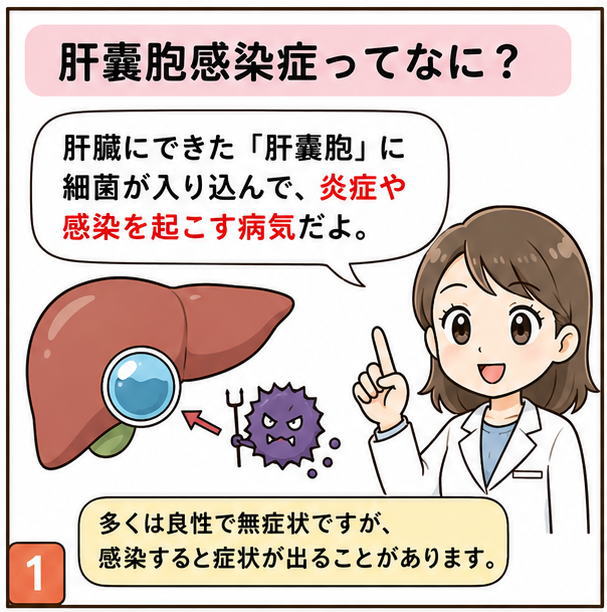 肝嚢胞感染症ってなに？というタイトルと「肝臓にできた肝嚢胞に細菌が入り込んで、炎症や感染を起こす病気だよ」と説明する白衣を着た女性のイラスト