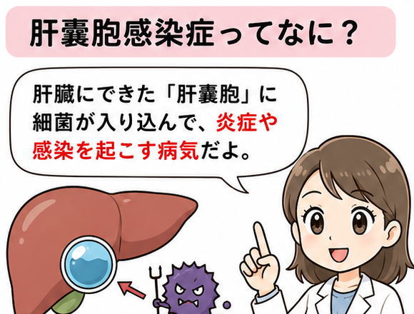 肝嚢胞感染症ってなに？という文字と、「肝臓にできた肝嚢胞に細菌が入り込んで、炎症や感染を引き起こす病気です」と解説する白衣を着た女性のイラスト