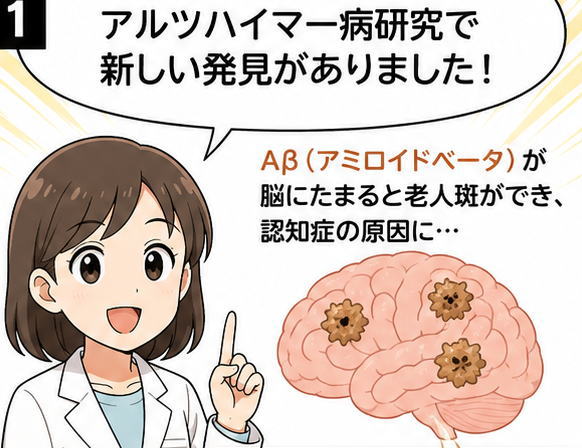 アルツハイマー病研究で新しい発見がありました！と話す白衣を着た女性と、脳のイラスト