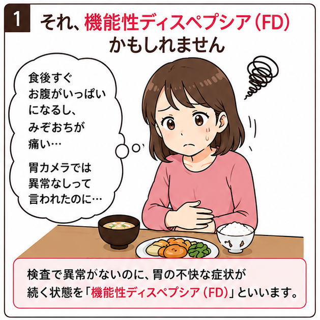 それ、機能性ディスペプシア（FD）かもしれません、というタイトルと、「食後すぐお腹がいっぱいになるし、みぞおちが痛い、胃カメラでは異常なしって言われたのに」とお腹を押さえる女性のイラスト
