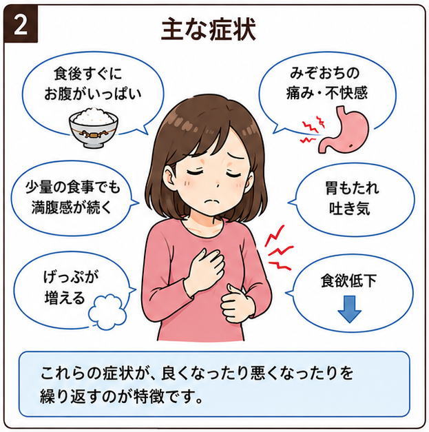 主な症状、というタイトルと、「食後すぐにお腹がいっぱい」「少量の食事でも満腹感が続く」「みぞおちの痛み・不快感」「胃もたれ吐き気」「げっぷが増える」「食欲低下」と書いた文字と、「これらの症状が、良くなったり悪くなったりを繰り返すのが特徴ですと書かれた文字とイラスト