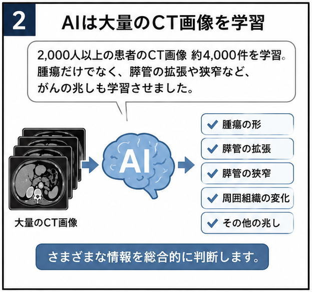 AIは大量のCT画像を学習というタイトルと、2000人以上の患者のＣＴ画像約4000件を学習。腫瘍だけでなく、膵管の拡張や狭窄など、がんの兆しも学習させました。という文字とＣＴ画像と脳のイラスト