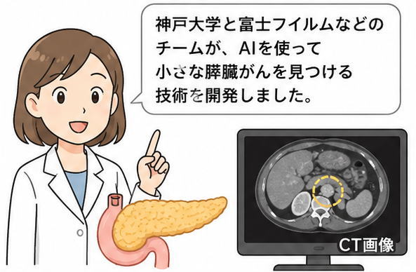 「神戸大学と富士フイルムなどのチームが、AIを使って小さな膵臓がんを見つける技術を開発しました。」と話す白衣を着た女性と膵臓とCT画像のイラスト