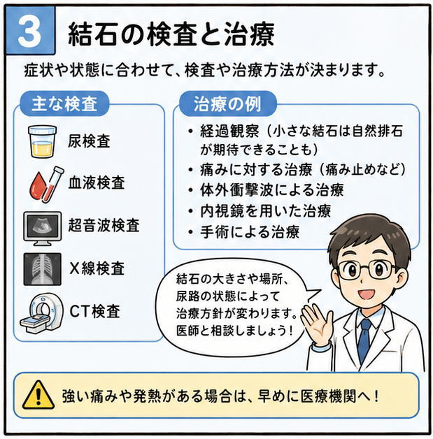 結石の検査と治療、というタイトルと、「症状や状態に合わせて、検査や治療方法が決まります。医師と相談しましょう」と話す医師のイラスト